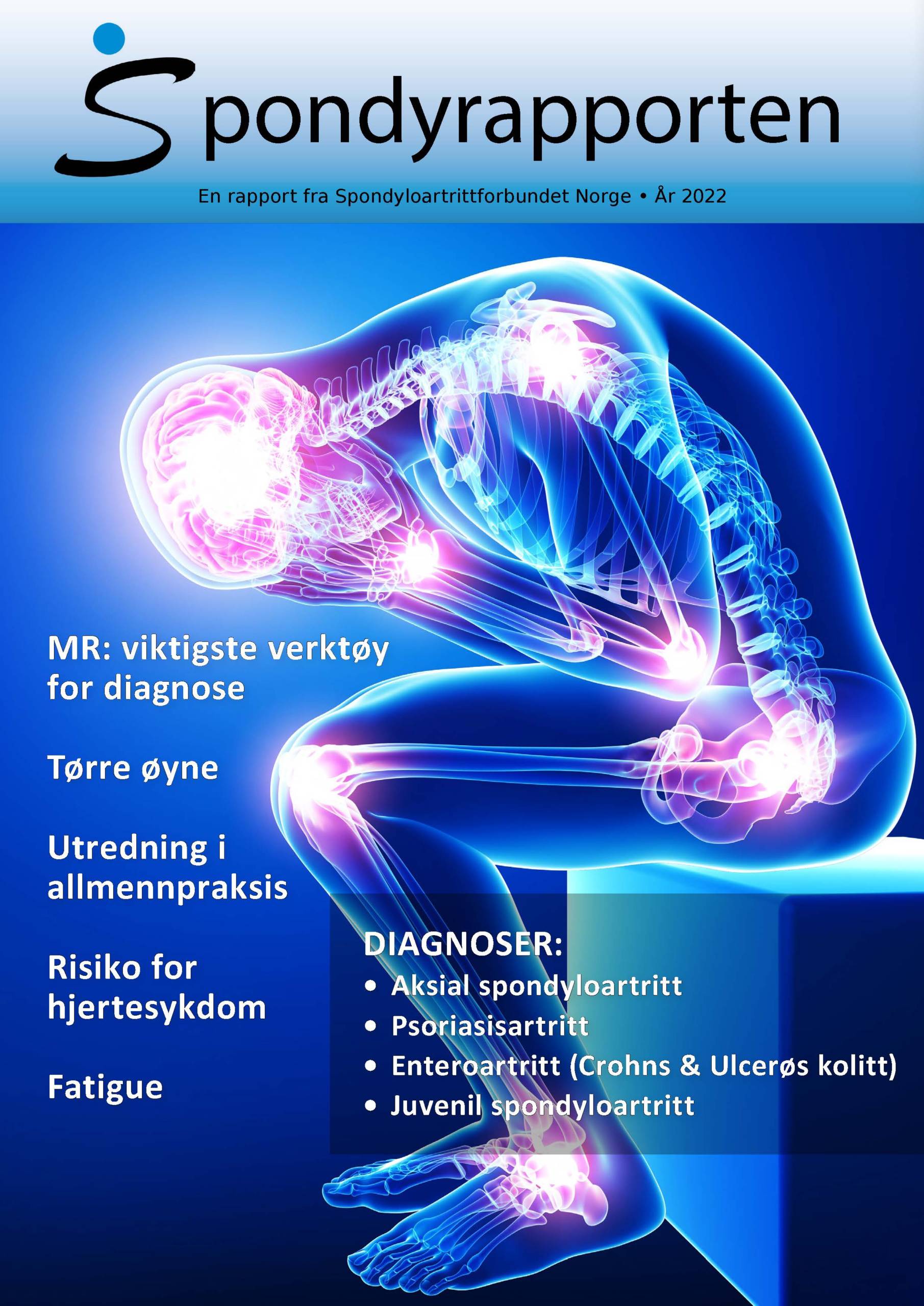 Spondyrapporten2022_medlemmer_Side_01 spondyrapporten