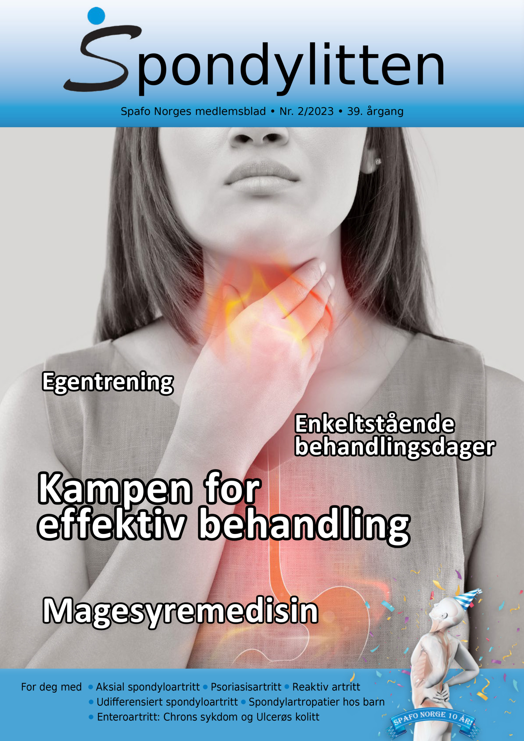 Forside-Spondylitten-2-23-scaled